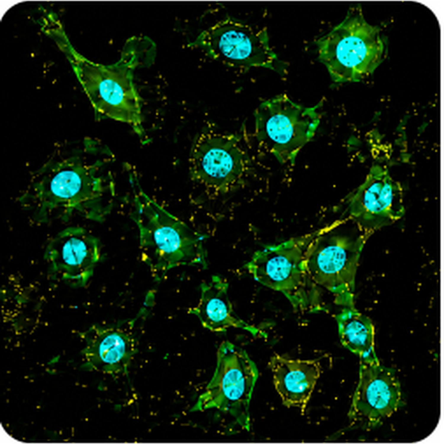 Fluorescence microscopy image of live cells